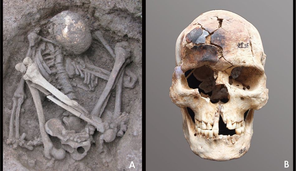 imageMomificación Antigua